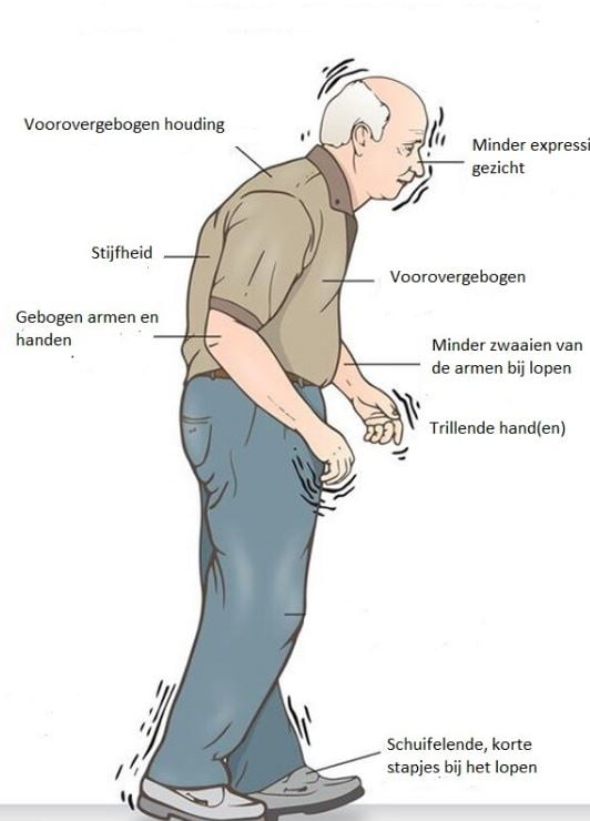 Parkonson symptomen
