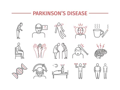 Parkinson