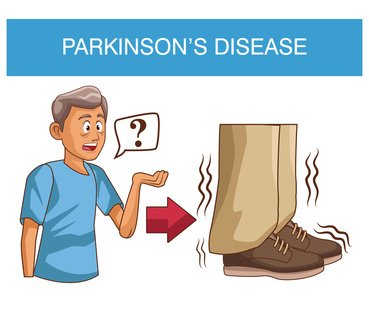 Parkinson