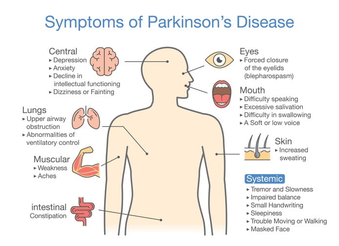 Parkinson's disease symptoms 